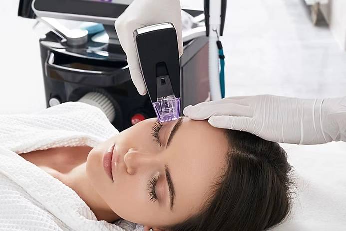 RF Microneedling